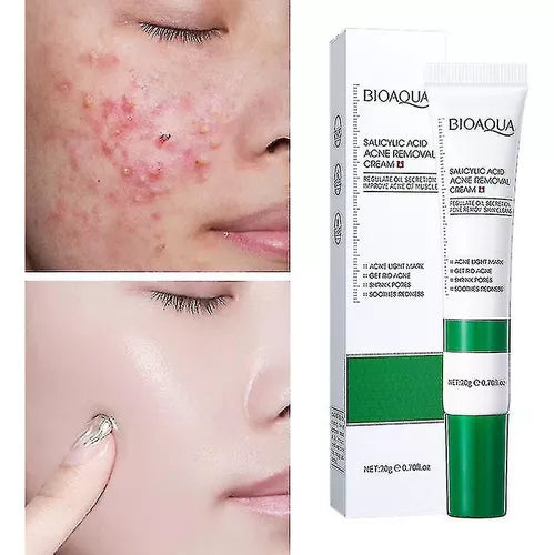 CREMA FACIAL ANTI ACNÉ ÁCIDO SALICÍLICO BIOAQUA