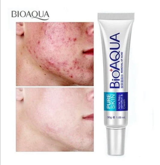 CREMA ANTI ACNÉ BIOAQUA