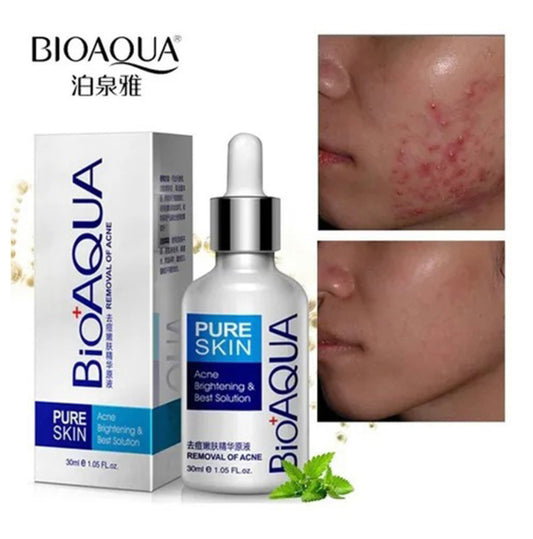 SUERO FACIAL ANTI ACNÉ BIOAQUA